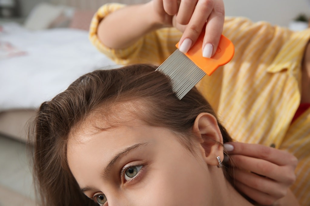 Head Lice Symptoms, Causes & Diagnosis LiceDoctors LiceDoctors